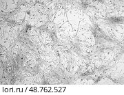 Клеточная культура глиобластомы под микроскопом. Стоковое фото, фотограф Сергей Дрозд / Фотобанк Лори