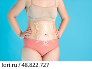 Abdomen liposuction, fat and cellulite removal concept, overweight female body with painted surgical lines and arrows. Стоковое фото, фотограф Станислав Тарко / Фотобанк Лори