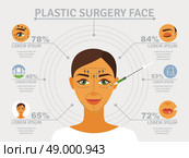 Plastic surgery face infographic poster. Cosmetic plastic facial surgery poster with infographic elements over eyelid correction and forehead lifts abstract vector illustration. Стоковая иллюстрация, агентство Ingram Publishing / Фотобанк Лори