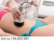 Woman getting anticellulite and anti fat therapy in beauty salon. Стоковое фото, агентство Ingram Publishing / Фотобанк Лори