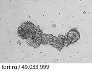 Сфероиды клеточной культуры глиобластомы человека. Стоковое фото, фотограф Сергей Дрозд / Фотобанк Лори