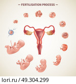 Human Fertilization Process Poster. Colored poster with scheme of human fertilization process and embryo development in realistic style vector illustration. Стоковая иллюстрация, агентство Ingram Publishing / Фотобанк Лори