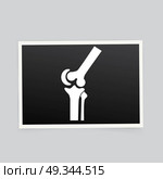 X-ray of the knee. Vector illustration. Стоковая иллюстрация, агентство Ingram Publishing / Фотобанк Лори