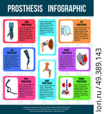 Artificial body parts organs mechanical heart valve kidney implants infographic poster with prothesis flat images vector illustration . Prothesis Flat Infographic Banner . Стоковая иллюстрация, агентство Ingram Publishing / Фотобанк Лори