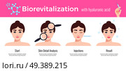 Beauty clinic cosmetology effective skin revitalization treatment steps description  with visual results horizontal flat advertising vector illustration . Cosmetology Revitalization Treatment . Стоковое фото, агентство Ingram Publishing / Фотобанк Лори