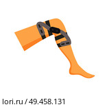Leg fixator for harmed leg vector illustration of special medicine overlay on human knee, orthopedic tool sample, image isolated on bright background. Leg Fixator for Harmed Leg Vector Illustration. Стоковая иллюстрация, агентство Ingram Publishing / Фотобанк Лори