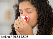 young woman with a bloody nose. Стоковое фото, агентство Ingram Publishing / Фотобанк Лори