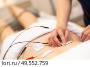 Physiotherapist applying electro stimulation in physical therapy to a young woman.. Electro stimulation in physical therapy to a young woman. Стоковое фото, агентство Ingram Publishing / Фотобанк Лори