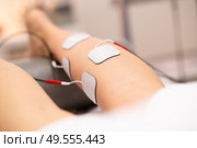 Electro stimulation in the leg in physical therapy to a young woman in a physiotherapy center.. Electro stimulation in physical therapy to a young woman. Стоковое фото, агентство Ingram Publishing / Фотобанк Лори