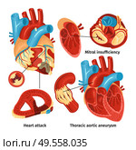 Flat icons set with heart anatomy and different types of diseases isolated on white background vector illustration. Стоковая иллюстрация, агентство Ingram Publishing / Фотобанк Лори