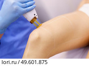 Woman receiving legs laser hair removal at a beauty center. Laser depilation treatment in an aesthetic clinic.. Woman receiving legs laser hair removal at a beauty center. Стоковое фото, агентство Ingram Publishing / Фотобанк Лори