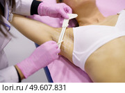 Doctor painting on the armpit of her middle-aged patient, the area to be treated for hyperhidrosis.. Doctor painting on the armpit of her patient, the area to be treated for hyperhidrosis. Стоковое фото, агентство Ingram Publishing / Фотобанк Лори