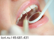 Close-up of woman at the dentist. Стоковое фото, агентство Ingram Publishing / Фотобанк Лори
