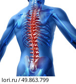 Human body backache and back pain with an upper torso body skeleton showing the spine and vertebral column in red highlight as a medical health care concept for spinal surgery and therapy on white background. Стоковое фото, агентство Ingram Publishing / Фотобанк Лори