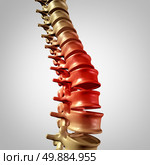 Spine pain and lower back disease and human backache with a three dimensional spinal body skeleton showing the vertebra and vertebral column in glowing red highlight as a medical health care concept for joint pain. Стоковое фото, агентство Ingram Publishing / Фотобанк Лори