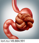 Nervous stomach problem and pain or stomachache and ulcer discomfort concept as a human digestive organ painfully wrapped with a tight rope knot as a medical healthcare stress and anxiety symptoms symbol. Стоковое фото, агентство Ingram Publishing / Фотобанк Лори