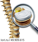 Lumbar spine anatomy segment medical concept as a close up of the human back skeleton as a vertebral magnification with a spinal cord and disk as a 3D illustration isolated on white. Стоковое фото, агентство Ingram Publishing / Фотобанк Лори