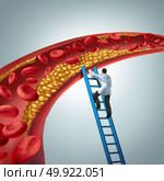 Cholesterol medical diagnosis concept as a doctor investigating atherosclerosis or arterial plaque clogging an artery with 3D render elements. Стоковое фото, агентство Ingram Publishing / Фотобанк Лори
