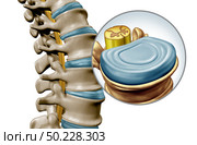 Lumbar spine disk anatomy segment medical concept as a close up of the human back skeleton as a vertebral magnification with a spinal cord and disk as a 3D illustration isolated on white. Стоковое фото, агентство Ingram Publishing / Фотобанк Лори