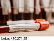 COVID-19 test and laboratory sample of blood testing for diagnosis new Corona virus infection(novel corona virus disease 2019)from Wuhan with laboratory background. Pandemic infectious concept. Стоковое фото, агентство Ingram Publishing / Фотобанк Лори