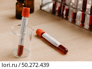 COVID-19 test and laboratory sample of blood testing for diagnosis new Corona virus infection(novel corona virus disease 2019)from Wuhan with laboratory background. Pandemic infectious concept. Стоковое фото, агентство Ingram Publishing / Фотобанк Лори