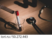 blood test result for the new rapidly spreading Coronavirus, originating in Wuhan, China. Стоковое фото, агентство Ingram Publishing / Фотобанк Лори