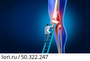 Knee pain care with the anatomy of a skeleton leg and showing the inside inflamation of the painful joint that needs surgery by an orthopedic surgeon and physical therapy by a doctor and therapist with 3D illustration elements. Стоковое фото, агентство Ingram Publishing / Фотобанк Лори