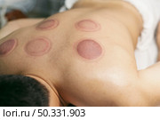 client suction cu session. High resolution photo. client suction cu session. High quality photo. Стоковое фото, агентство Ingram Publishing / Фотобанк Лори