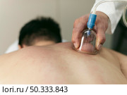 man suction cups session close up. Стоковое фото, агентство Ingram Publishing / Фотобанк Лори