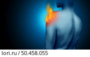 Burning Shoulder Pain and painful rotator cuff joint pain and tendon injury as chronic burning pain inflammation due to an injury or work accident of the shoulders in a 3D illustration style on a blue background. Стоковое фото, агентство Ingram Publishing / Фотобанк Лори