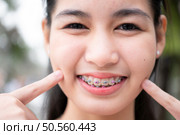 Portrait of a young asian woman with braces on her teeth. Стоковое фото, агентство Ingram Publishing / Фотобанк Лори