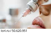 Close-up of a beauty treatment with serum being applied near lips in a modern spa setting during daylight hours. Стоковое AI-изображение, AI-художник Сергей Толмачёв / Фотобанк Лори
