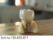 Dental implant model showing tooth, bone and screw. Стоковое AI-изображение, AI-художник Иван Рябоконь / Фотобанк Лори