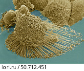 Scanning electron micrograph of an apoptotic HeLa cell. Стоковое фото, фотограф National Institutes of Health /Stocktrek/Stocktrek Images / ТАСС / Фотобанк Лори