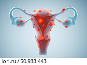 Detailed 3D Illustration of a Female Reproductive System Highlighting Structural Features and Cellular Changes Essential for Understanding Gynecological Health. Стоковое AI-изображение, AI-художник Башкирова Анна / Фотобанк Лори