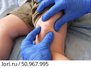Doctor examining child with bodily red rash. Kid allergy closeup. Little baby scratches an eruption. Nurse applies special cream to atopic skin. Dermatitis, irritation, hive. Pruritus. Mosquito bites. Стоковое фото, фотограф Марина Демидюк / Фотобанк Лори