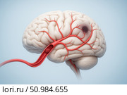 Detailed digital rendering of a human brain with highlighted artery blockage, visualizing ischemic stroke pathway for medical or educational use. Стоковое AI-изображение, AI-художник Башкирова Анна / Фотобанк Лори