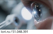 Eye examination process reveals intricate details of vision testing in a clinical setting. Стоковое AI-видео, аниматор Сергей Толмачёв / Фотобанк Лори