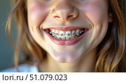Девушка с брекетами улыбается на камеру крупным планом / A girl with braces smiles at the camera in close-up. Стоковое AI-изображение, AI-художник Валерий Лукин / Фотобанк Лори
