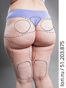Buttocks liposuction, fat and cellulite removal, overweight female body with painted surgical lines, plastic surgery concept. Стоковое фото, фотограф Станислав Тарко / Фотобанк Лори