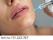 Крупный план инъекции в губы, выполняемой шприцем для косметической процедуры. Стоковое AI-изображение, AI-художник Кирилл Сиротюк / Фотобанк Лори