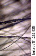 Microscopic image of cat fur affected by ringworm. Individual hairs are clearly visible under magnification, showing characteristic damage and deposits of fungal infection. In some places, the hair structure is destroyed, and accumulations of spores and plaque are visible. The background is light, which emphasizes the dark threads of the fur and the affected areas. The image is suitable for use in educational and scientific materials, veterinary publications, articles on dermatophytosis and skin diseases of animals, as well as in medical and microbiological research. Стоковое фото, фотограф Анна Кривицкая / Фотобанк Лори