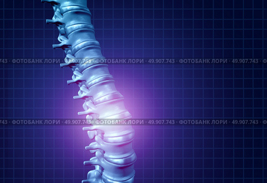 Back spine pain and human backache as a skeleton showing the spine and vertebral column in glowing highlight as a medical health care concept for spinal health and therapy as a 3D illustration. Стоковое фото, агентство Ingram Publishing / Фотобанк Лори