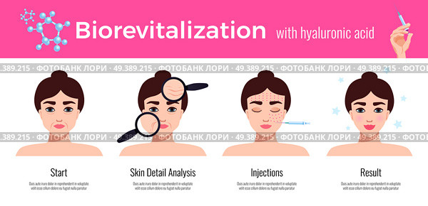 Beauty clinic cosmetology effective skin revitalization treatment steps description  with visual results horizontal flat advertising vector illustration . Cosmetology Revitalization Treatment . Стоковое фото, агентство Ingram Publishing / Фотобанк Лори