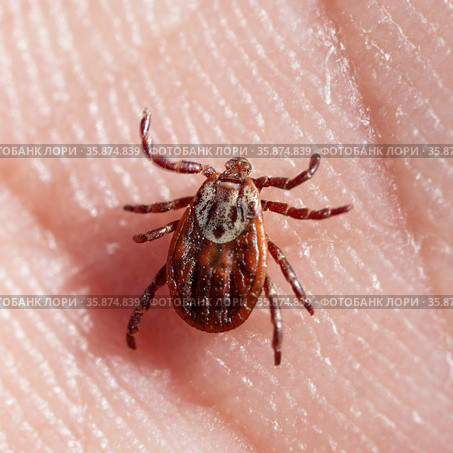 Blood-sucking mite on a human skin macro. Стоковое фото, фотограф Георгий Дзюра / Фотобанк Лори