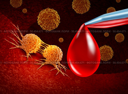 Cancer screening and blood test for early detection of malignant cells in a human body caused by carcinogens and genetics with a cancerous cell as an immunotherapy symbol and medical therapy diagnosis as a 3D illustration. Стоковое фото, агентство Ingram Publishing / Фотобанк Лори