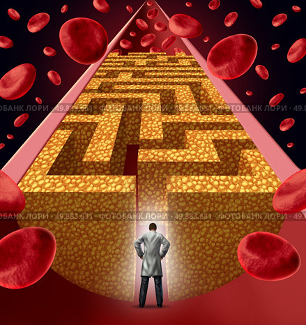 Cholesterol treatment by a heart surgeon doctor facing a clogged artery and atherosclerosis disease medical concept with a three dimensional human artery with blood cells that is blocked by plaque buildup of cholesterol shaped as a maze as a symbol of vascular diseases proplems. Стоковое фото, агентство Ingram Publishing / Фотобанк Лори