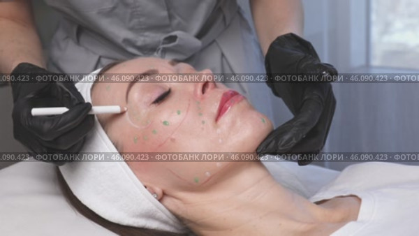 Close-up. Before the procedure for facial contouring or plastic surgery, the cosmetologist makes markings on the patient face. Time to prepare for a cosmetic procedure. Footage. Стоковое видео, видеограф Ирина Михайличенко / Фотобанк Лори