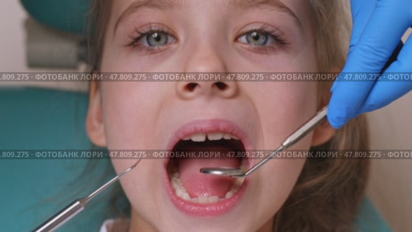 Close up dentist, doctor examines the oral cavity of a little girl, uses a mouth mirror, baby teeth close-up. Concept of pediatric dentistry, dental treatment. Slow motion footage. Стоковое видео, видеограф Ирина Михайличенко / Фотобанк Лори