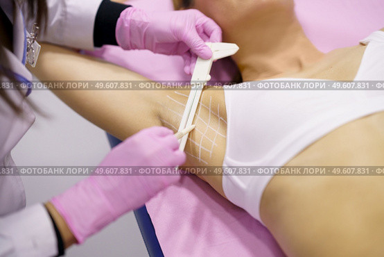 Doctor painting on the armpit of her middle-aged patient, the area to be treated for hyperhidrosis.. Doctor painting on the armpit of her patient, the area to be treated for hyperhidrosis. Стоковое фото, агентство Ingram Publishing / Фотобанк Лори